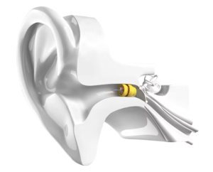 Phonak Lyric™ 100% invisible hearing aid